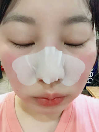 나이팅게일 TAKO PACK NOSE [문어코팩] — 4점을 준 리뷰어가 2017년 4월 올린 사용 사진