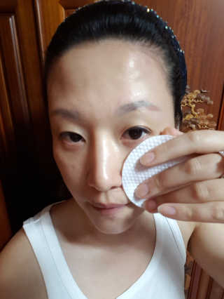 미플레이 진짜 티트리 토너 패드 — 5점을 준 리뷰어가 2018년 11월 올린 사용 사진