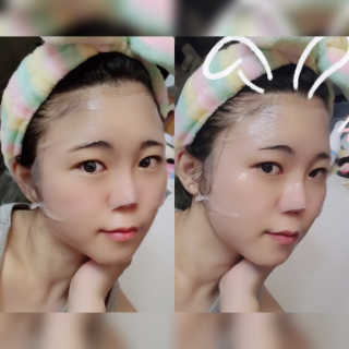 셀더마 마린 콜라겐 하이드로겔 마스크팩 5박스 — 3점을 준 리뷰어가 2020년 3월 올린 사용 사진