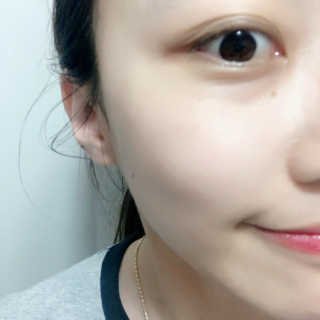 23years old 바데카실 프로 엑스퍼트 앰플 — 3.67점을 준 리뷰어가 2018년 7월 올린 사용 사진