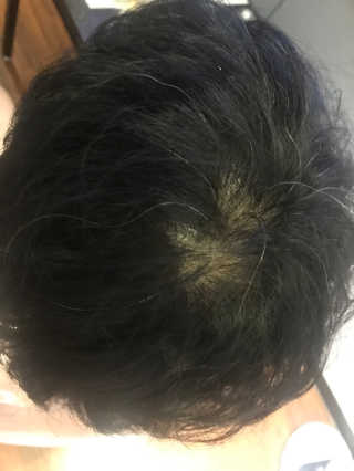 메디힐 비쥬드-헤어 컬러 스타일링 코팅[코팅제] — 5점을 준 리뷰어가 2018년 9월 올린 사용 사진