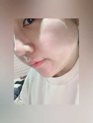 자이엘 S.O.S 레드 칙 케어팩 2 Box — 5점을 준 리뷰어가 2020년 1월 올린 사용 사진