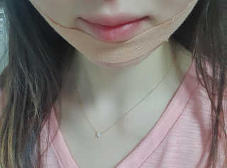 아이디플라코스메틱 아이디 페이스핏 마이너스 밴드 — 3점을 준 리뷰어가 2020년 3월 올린 사용 사진