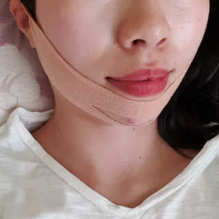 아이디플라코스메틱 아이디 페이스핏 마이너스 밴드 — 3.5점을 준 리뷰어가 2019년 9월 올린 사용 사진