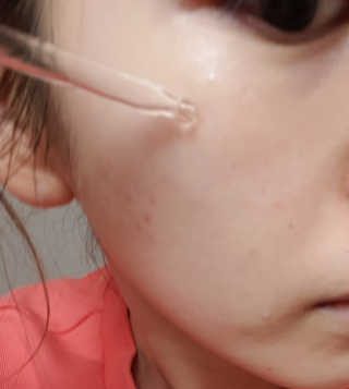 키노닉스 펀더멘탈 하이드레이팅 앰플 부스터 — 5점을 준 리뷰어가 2019년 2월 올린 사용 사진