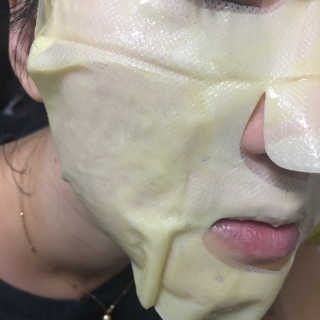 23years old 씨트라 더마실 마스크 — 5점을 준 리뷰어가 2018년 11월 올린 사용 사진
