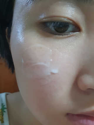 쏘내추럴 화이트닝 스팟 코렉터 — 5점을 준 리뷰어가 2019년 9월 올린 사용 사진