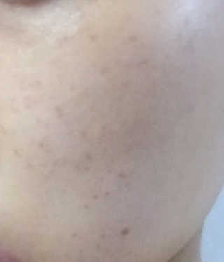 결정장애님이 올린 리뷰 사진 2
