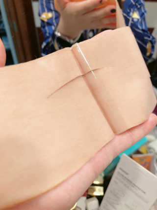 아이디플라코스메틱 아이디 페이스핏 마이너스 밴드 — 1.5점을 준 리뷰어가 2019년 10월 올린 사용 사진