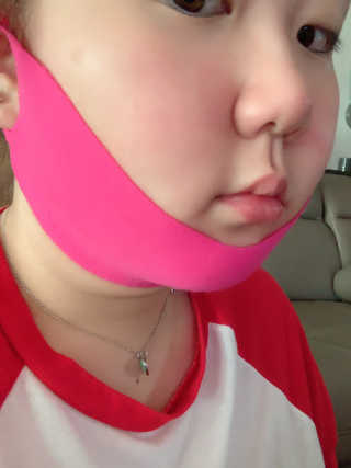 스케덤 펩타이드 리프팅밴드 — 5점을 준 리뷰어가 2019년 6월 올린 사용 사진