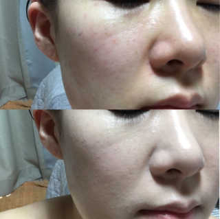 kiring0614님이 올린 리뷰 사진 1