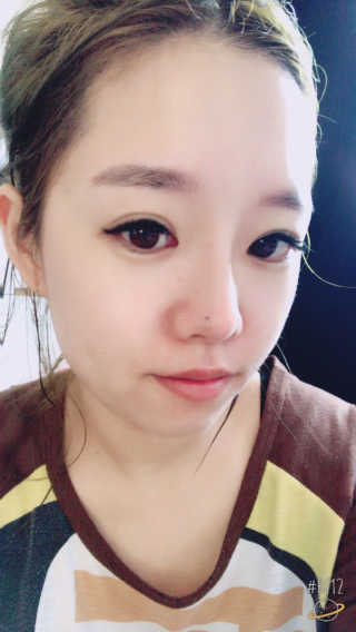 더연 리파이닝 칼라민크림 — 5점을 준 리뷰어가 2017년 11월 올린 사용 사진