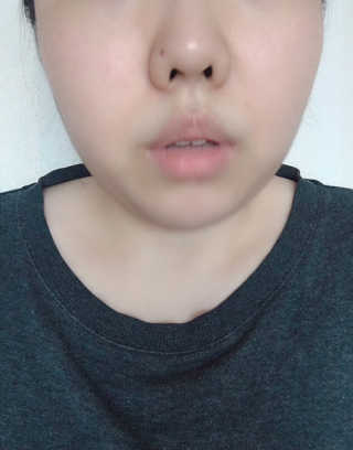 스케덤 시카 리프팅밴드 — 3.5점을 준 리뷰어가 2019년 3월 올린 사용 사진