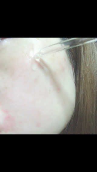 [마녀 공장] 발가락 토미 니아신 에센스 50ml — 5점을 준 리뷰어가 2019년 3월 올린 사용 사진
