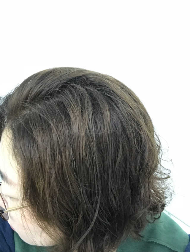 닥터원더 원더 헤어트리트먼트 리뷰 사진