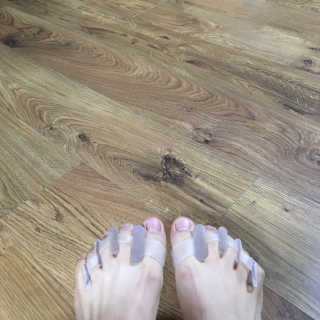 힐링팩토리 밸런스 발가락링 발가락교정기 A1 — 5점을 준 리뷰어가 2019년 12월 올린 사용 사진