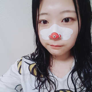 나이팅게일 TAKO PACK NOSE [문어코팩] — 5점을 준 리뷰어가 2018년 5월 올린 사용 사진