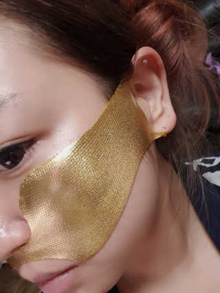 [스케덤] 상악밴드 — 5점을 준 리뷰어가 2019년 6월 올린 사용 사진