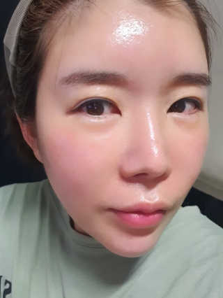 메디페르 루테인앰플 10ml 4개 — 5점을 준 리뷰어가 2020년 3월 올린 사용 사진
