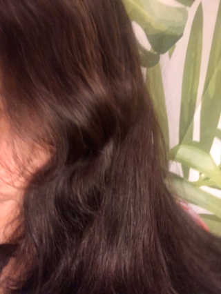 아이로로 디어 스칼프 인핸 시브 안티 헤어 로스 트리트먼트 — 4.5점을 준 리뷰어가 2019년 11월 올린 사용 사진