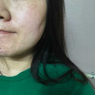 나이팅게일 티타민 크림 리뉴얼 — 4점을 준 리뷰어가 2018년 4월 올린 사용 사진