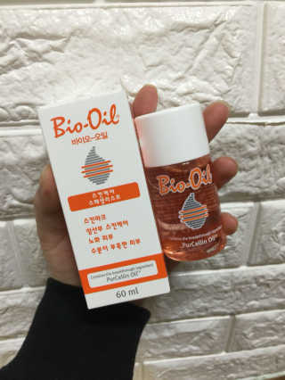 Bio-oil(바이오오일) 바이오오일(Bio-oil) — 5점을 준 리뷰어가 2016년 12월 올린 사용 사진