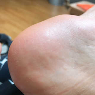 촉별님님이 올린 리뷰 사진 3
