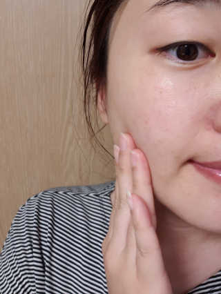 2018 아이소이 잡티세럼 리미티드 컬렉션 — 5점을 준 리뷰어가 2018년 6월 올린 사용 사진
