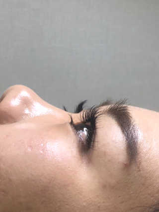 Viewty Skin and Lash [ViewtySkin＆Lash] 종아리 림프순환 부종관리 — 3점을 준 리뷰어가 2019년 2월 올린 사용 사진