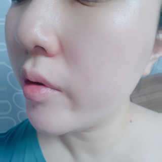 클레어테라피 프로 캄 페이셜 수딩 크림 — 5점을 준 리뷰어가 2019년 1월 올린 사용 사진