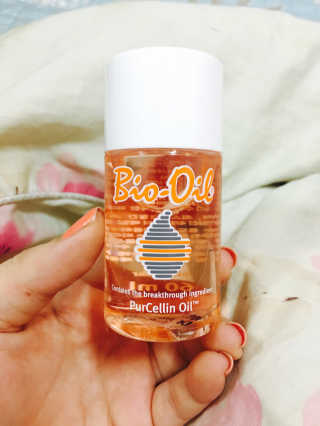 Bio-oil(바이오오일) 바이오오일(Bio-oil) — 3점을 준 리뷰어가 2017년 1월 올린 사용 사진