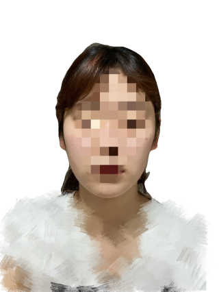 아이디플라코스메틱 아이디 페이스핏 마이너스 밴드 — 5점을 준 리뷰어가 2020년 4월 올린 사용 사진