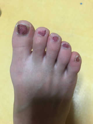 피치피치님이 올린 리뷰 사진 2