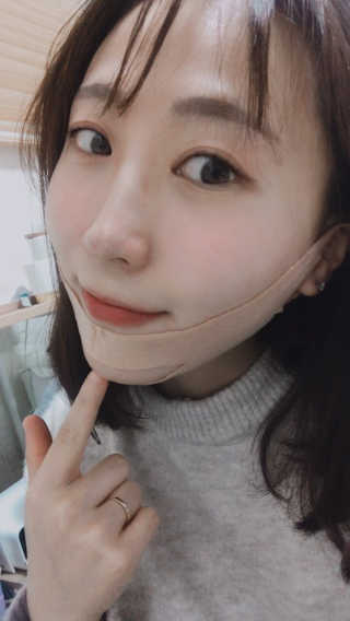 아이디플라코스메틱 아이디 페이스핏 마이너스 밴드 — 3.5점을 준 리뷰어가 2019년 10월 올린 사용 사진