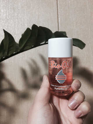Bio-oil(바이오오일) 바이오오일(Bio-oil) — 3.5점을 준 리뷰어가 2017년 2월 올린 사용 사진