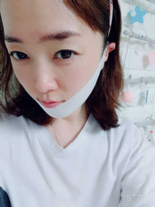 스케덤 클루덤 리프팅 패치 — 4점을 준 리뷰어가 2019년 4월 올린 사용 사진