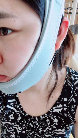 메디미 브이미 업 2스텝 브이라인벨트 — 4점을 준 리뷰어가 2017년 9월 올린 사용 사진
