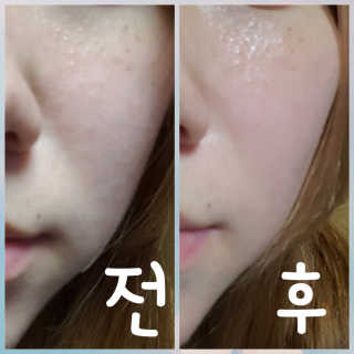 23years old 씨트라겔 프로텍트 밤 — 5점을 준 리뷰어가 2016년 9월 올린 사용 사진