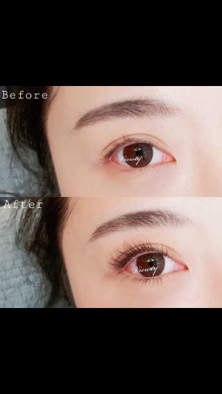 Viewty Skin and Lash [ViewtySkin＆Lash] 종아리 림프순환 부종관리 — 3점을 준 리뷰어가 2019년 3월 올린 사용 사진