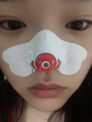 나이팅게일 TAKO PACK NOSE [문어코팩] — 2.83점을 준 리뷰어가 2018년 6월 올린 사용 사진