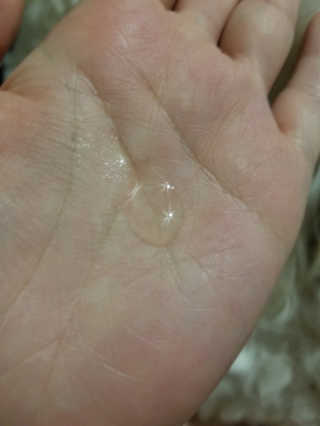 [마녀 공장] 발가락 토미 니아신 에센스 50ml — 4.5점을 준 리뷰어가 2018년 8월 올린 사용 사진