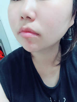 나이팅게일 티타민 크림 리뉴얼 — 4.83점을 준 리뷰어가 2018년 8월 올린 사용 사진