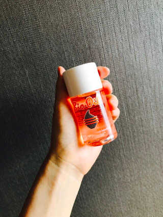 Bio-oil(바이오오일) 바이오오일(Bio-oil) — 5점을 준 리뷰어가 2017년 1월 올린 사용 사진
