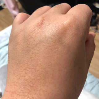 셀퓨전씨 카밍 다운 크림 — 4점을 준 리뷰어가 2018년 11월 올린 사용 사진