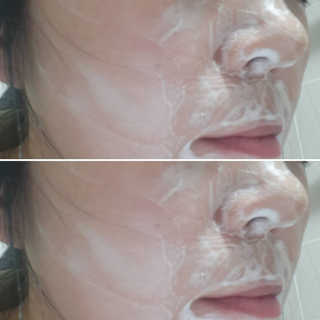 아크웰 아크네 클리어링 딥 클렌징 폼 — 5점을 준 리뷰어가 2018년 11월 올린 사용 사진