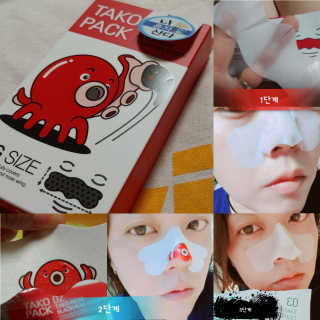 나이팅게일 TAKO PACK NOSE [문어코팩] — 5점을 준 리뷰어가 2018년 7월 올린 사용 사진