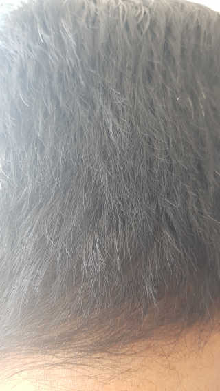 [크리산] 비듬케어 안티슈펜 샴푸 인텐시브 — 4점을 준 리뷰어가 2020년 3월 올린 사용 사진