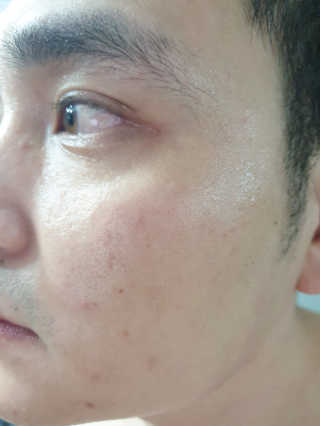 오바코 ovaco 오바코 툼9 젠틀포맨 올인원 에센스 — 4점을 준 리뷰어가 2019년 5월 올린 사용 사진