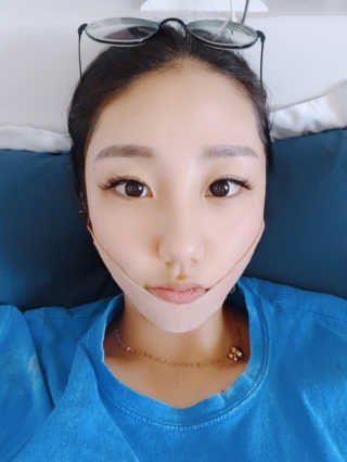 아이디플라코스메틱 아이디 페이스핏 마이너스 밴드 — 5점을 준 리뷰어가 2019년 10월 올린 사용 사진