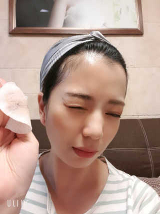 나이팅게일 데일리 더마 클렌징패드 마일드 — 4점을 준 리뷰어가 2018년 12월 올린 사용 사진